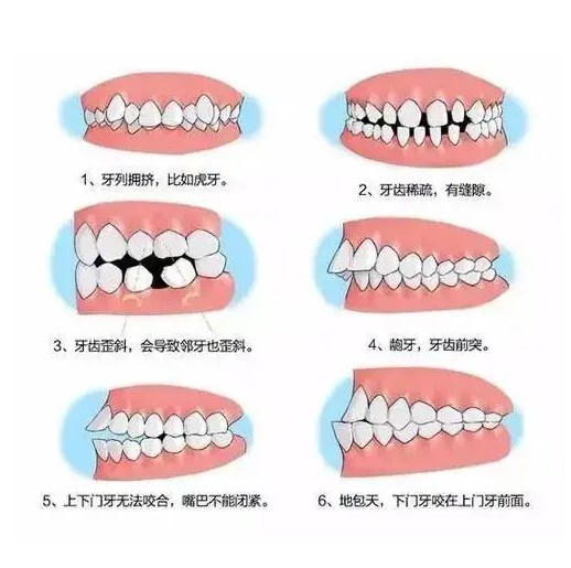 牙齿矫正,兰州牙齿矫正,隐形矫正,牙齿矫正多少钱