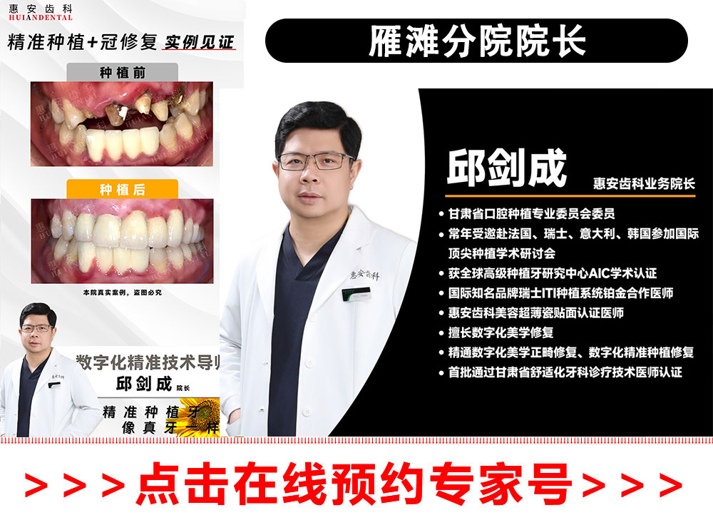 兰州牙科，兰州口腔，兰州种植牙，兰州种植牙，兰州种植牙医院，兰州种植牙口腔