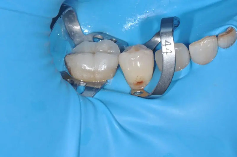 兰州牙科，兰州种植牙，兰州口腔，兰州种植牙医院，兰州种植牙口腔